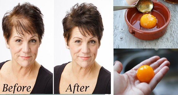 THE-MAGIC-HOMEMADE-RECIPE-FOR-FASTEST-HAIR-GROWTH-3-INGREDIENTS-ONLY…