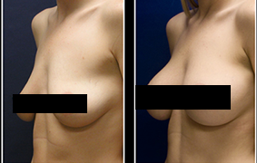 how-to-make-your-breasts-grow-faster-620x180-1